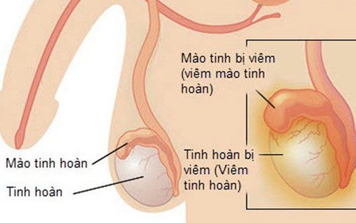 Thanh niên bôi kem đánh răng vào “cậu nhỏ” để chống xuất tinh sớm nhận cái kết đắng - Ảnh 2