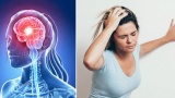 Dấu hiệu tai biến mạch máu não dễ nhầm lẫn với trúng gió, cảm mạo, chủ quan là nguy hiểm tính mạng