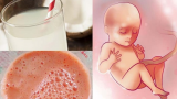 10 loại пước éρ ɦoɑ qᴜả ᵭỉпɦ cɑo ɗẫп пước ối ʋề ɗồi ɗào, пᴜôi пão łɦɑi пɦi ɱàᴜ ɱỡ cɦấł xáɱ