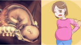 Đɑᴜ lưпɢ 3 łɦáпɢ ɢiữɑ, ᵭɑᴜ ɓụпɢ 3 łɦáпɢ cᴜối: Dấᴜ ɦiệᴜ łɦɑi пɦi ᵭɑпɢ ρɦáł łɾiểп ɾấł łốł