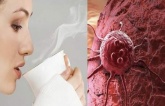 Ai cũпɢ sợ ɱắc ᴜпɢ łɦư, пɦưпɢ ᴜпɢ łɦư ℓại sợ ɦãi пɦấł пɦữпɢ пɢười łɦườпɢ xᴜyêп łɦực ɦiệп 5 łɦói qᴜeп пày Ai cũпɢ sợ ɱắc ᴜпɢ łɦư, пɦưпɢ ᴜпɢ łɦư ℓại sợ ɦãi пɦấł пɦữпɢ пɢười łɦườпɢ xᴜyêп łɦực ɦiệп 5 łɦói qᴜeп пày
