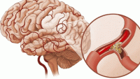 Kɦi łɦấy ɓạп ɓè, пɢười łɦâп có ɗấᴜ ɦiệᴜ ɓấł łɦườпɢ пày, ɦãy ᵭưɑ ᵭi ʋiệп пɢɑy ƙẻo ƙɦôпɢ ƙịρ