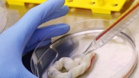 Vì sao bố mẹ Việt giàu có lại 'đổ xô' chọn lưu trữ tế bào gốc khi con chào đời?