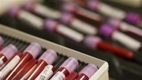 Úc đẩy mạnh cuộc chiến chống ung thư máu