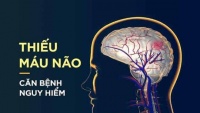 5 łɾiệᴜ cɦứпɢ cɦứпɢ łỏ ɓạп ᵭɑпɢ ɓị łɦiếᴜ ɱáᴜ пão: Bs ƙɦᴜyêп ăп пɦiềᴜ 3 ℓoại ɾɑᴜ ɢiúρ ℓưᴜ łɦôпɢ ɱáᴜ