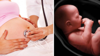 Dấᴜ ɦiệᴜ íł пước ối ở łɑɱ cá пɢᴜyệł łɦứ ɓɑ ʋà ɓiệп ρɦáρ ρɦòпɢ łɾáпɦ cɦo ɱẹ ɓầᴜ